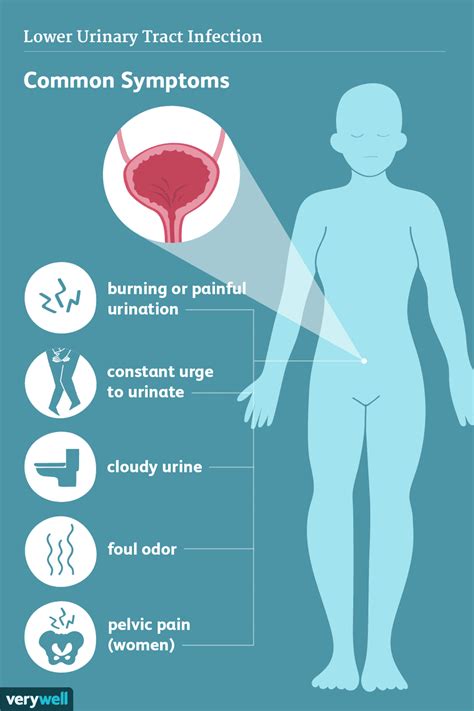 Urinary tract infection (lower)